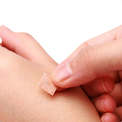 GB 2024-2016 إبر الضغط للإبر الصينية 0.2 مم × 1.5 مم لأجهزة الطب الصيني معيار السلامة للخصائص