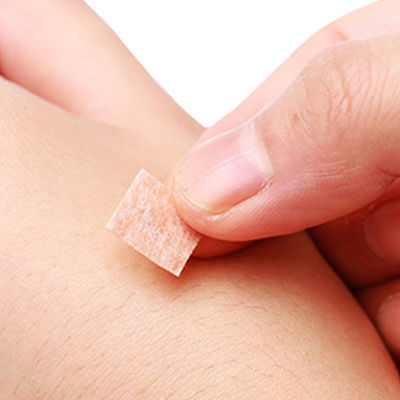 طريقة تعقيم غاز أكسيد الإيثيلين Acu Press Needles CE TUV ISO GMP Certification
